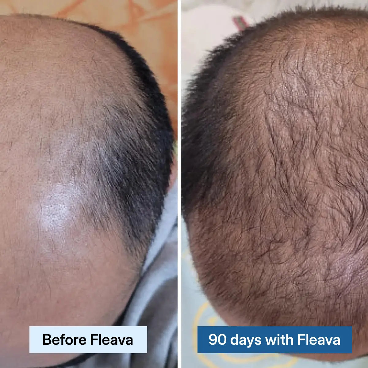 Fórmula avanzada para el crecimiento del cabello con péptidos de cobre